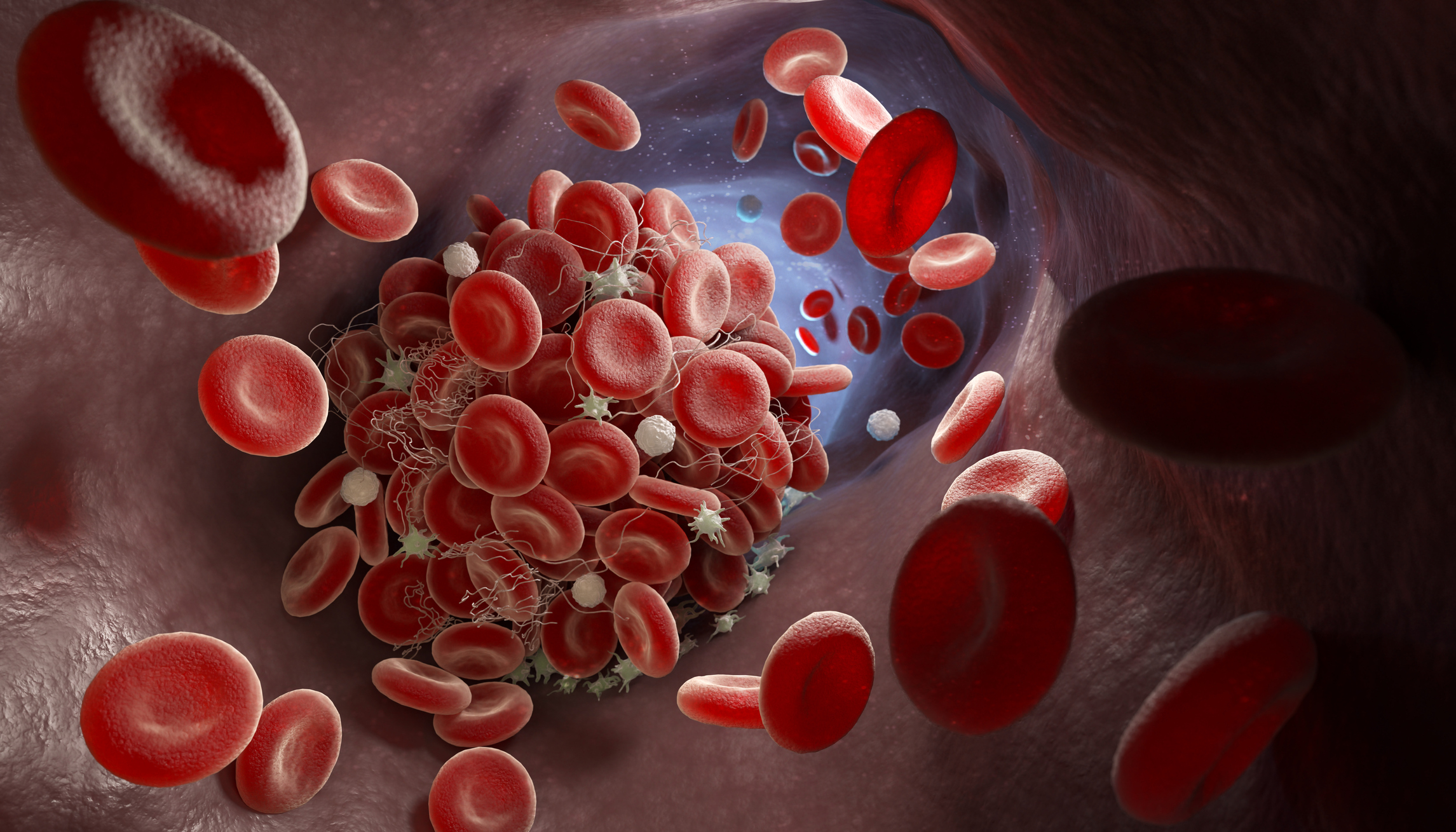 Depiction of red blood cells forming a blood clot