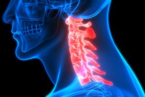 Anterior Cervical Discectomy and Fusion