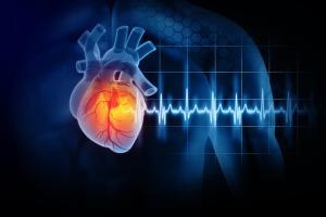 Diagram of an enlarged heart