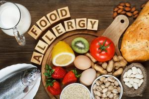 Display of food on a table with blocks spelling 'allergens'