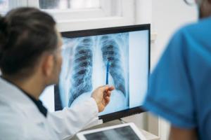 Patient looking at lung x-rays with doctor