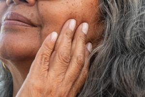 Close-up of a woman feeling her face, checking for liver spots and dark patches