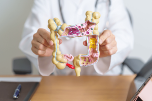 Doctor holding a 3D model of the colon, illustrating diverticulosis and diverticulitis conditions for digestive health education.