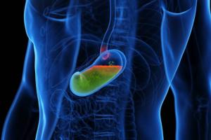 Digital illustration of acid reflux in the esophagus, highlighting gastroesophageal reflux disease (GERD) and its impact on the digestive system.